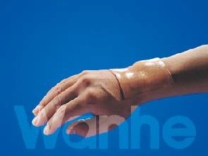 Adesivos de cicatriz médica de silicone Evitar cicatriz Hiperplasia de silicone Folha de gel